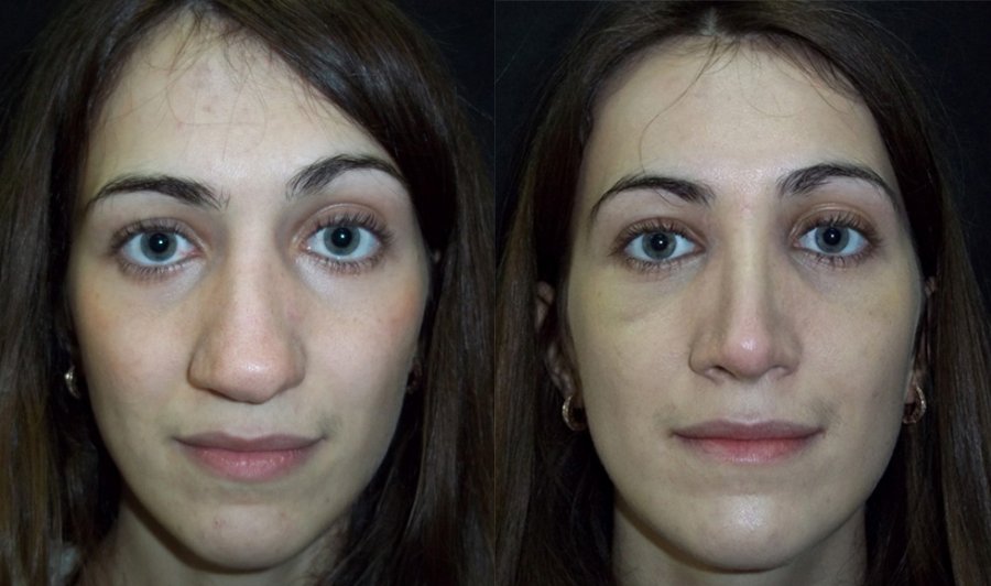 Похожее изображение